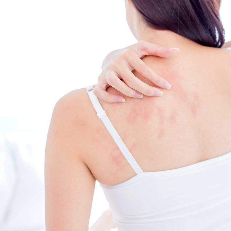 Dermaplan